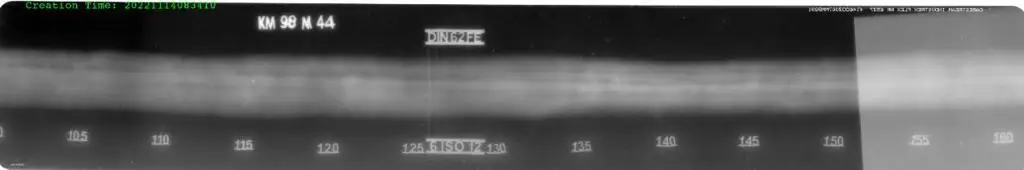 Computed Radiography sample image 4
