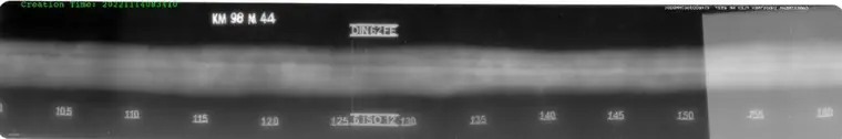 Computed Radiography sample image 4